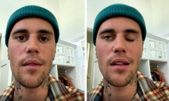 Children ask why I've got a wonky face': life with Justin Bieber's ...