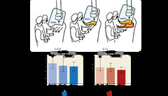 Effectiveness of additional X-ray protection devices in reducing ...