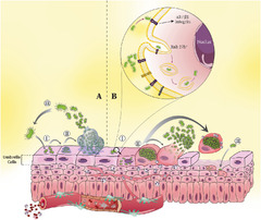 Uropathogenic Escherichia coli endeavors: an insight into the ...