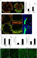 MT1-MMP sheds LYVE-1 on lymphatic endothelial cells and suppresses ...