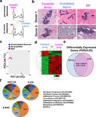 Upregulation of lipid metabolism genes in the breast prior to ...