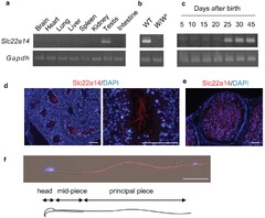 A critical role of solute carrier 22a14 in sperm motility and male ...