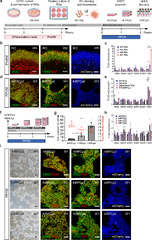 Human iPSC-derived retinal progenitors