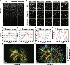 Optical coherence tomography angiography