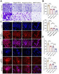 Hepatocyte-like cells derived from human induced pluripotent stem cells