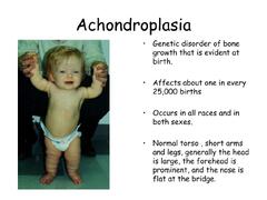 PPT - Classifying Genetic Disorders PowerPoint Presentation, ...