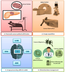 Pancreatic Cancer