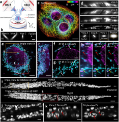 Human brain organoids