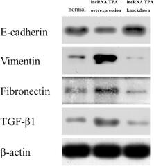 Frontiers | Study of lncRNA TPA in Promoting Invasion and ...