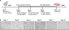 iPSC-derived smooth muscle cells