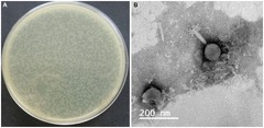 Frontiers | Isolation and characterization of phage ISTP3 for bio ...