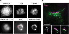 Frontiers | Unraveling the Nanoscopic Organization and Function of ...