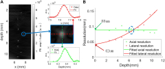 Frontiers | Photoacoustic Mouse Brain Imaging Using an Optical ...