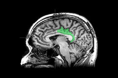 Brain Study Suggests Traumatic Memories Are Processed as Present ...