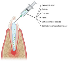 IJMS |-Text | Bioactive Endodontic Hydrogels: From ...