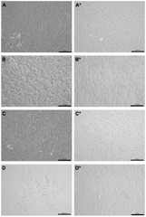 IJMS |-Text | Regulation of Immune Checkpoint Antigen ...