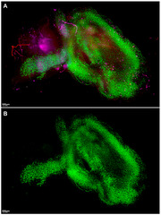 IJMS |-Text | Second Wave, Late-Stage Neuroinflammation ...