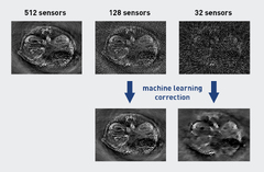 Artificial intelligence improves biomedical imaging | ETH Zurich