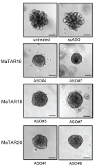 Non-coding%20portions%20of%20genome%20are%20found%20to%20play%20role%20in%20cancer