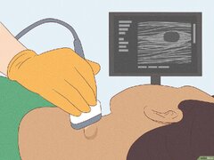 How to Check Your Lymph Nodes for Signs of Swelling