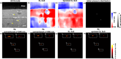 Learning-based sound speed estimation and aberration correction ...